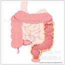 Large intestine polyp
