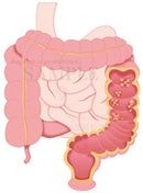 Large intestine polyp