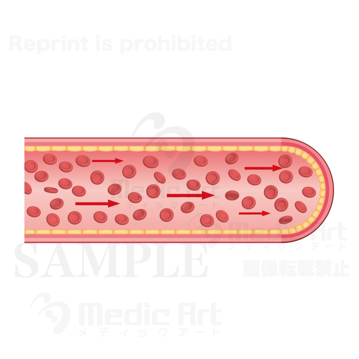 動脈硬化の進行1：正常な血管の場合