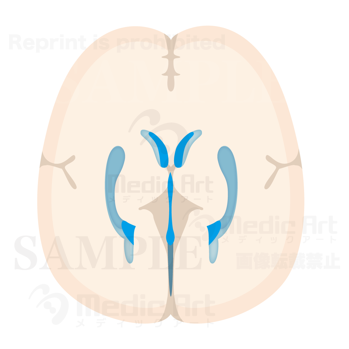 Horizental section of Cerebralventricle2(Judging from superior aspect)
