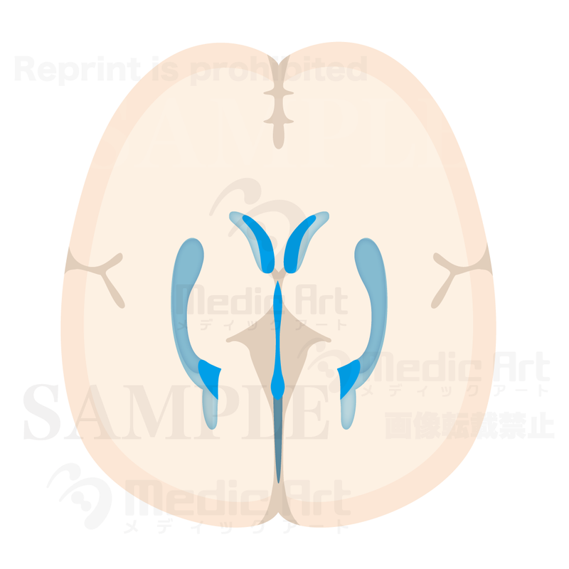 Horizental section of Cerebralventricle2(Judging from superior aspect)