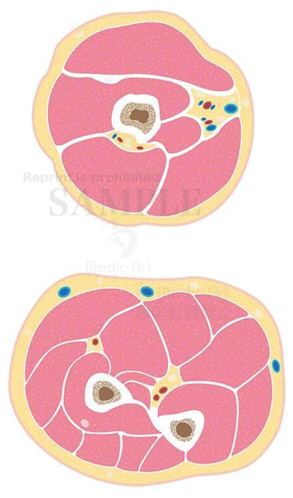 The cross-section of arm muscles (cross-section of the upper arm and the forearm)