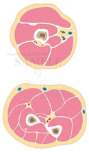 腕の筋肉の断面（上腕と前腕の横断面）
