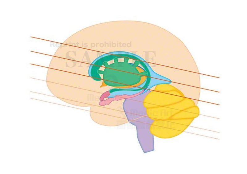 Basal ganglia,Diencephalon and cerebellar section(Horizontal section)