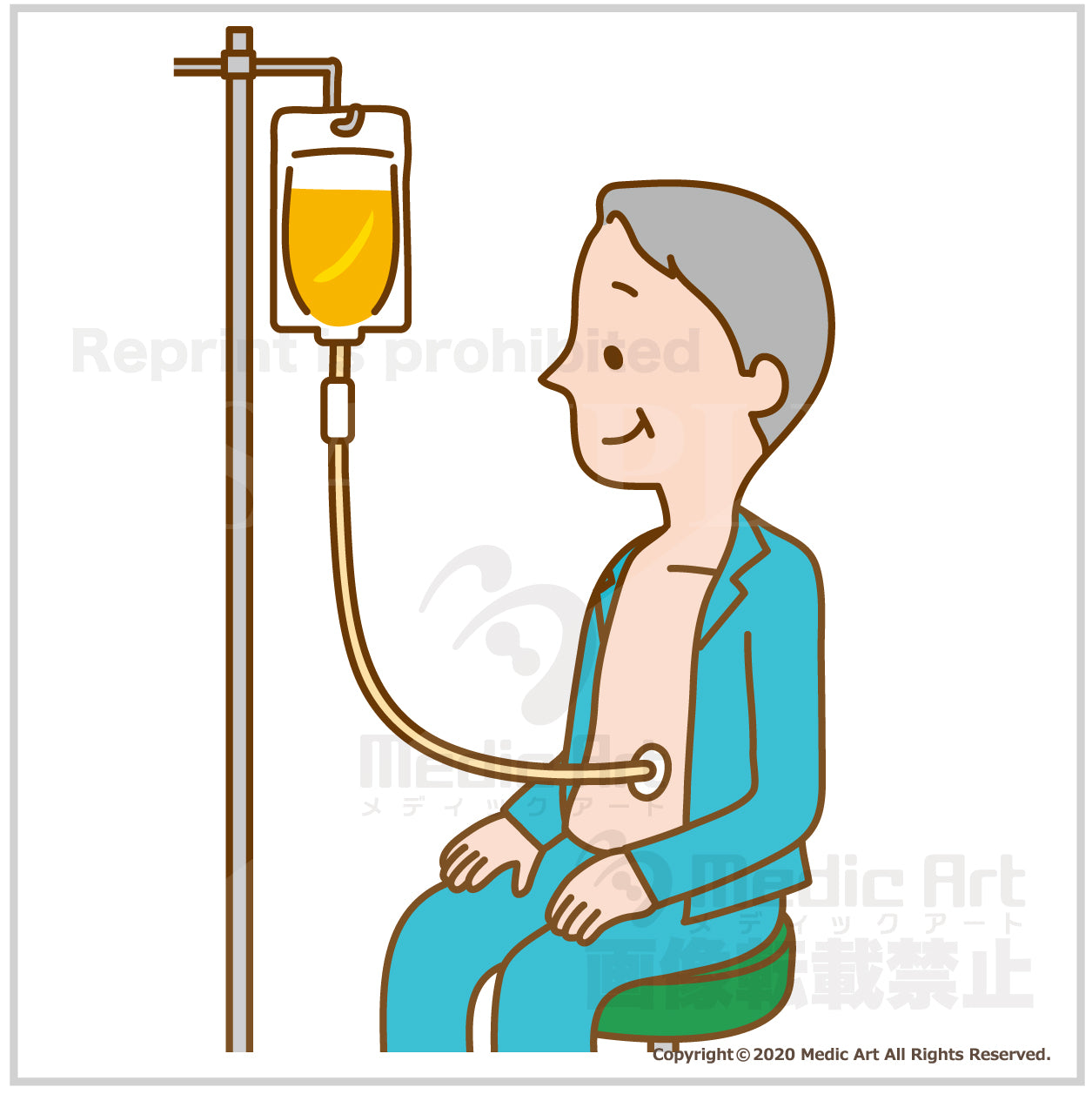 The gastric fistula (PEG: Percutaneous Endoscopic Gastrostomy)