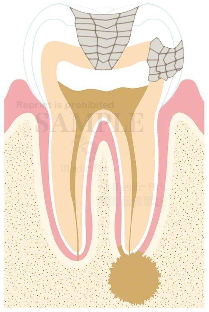 3B