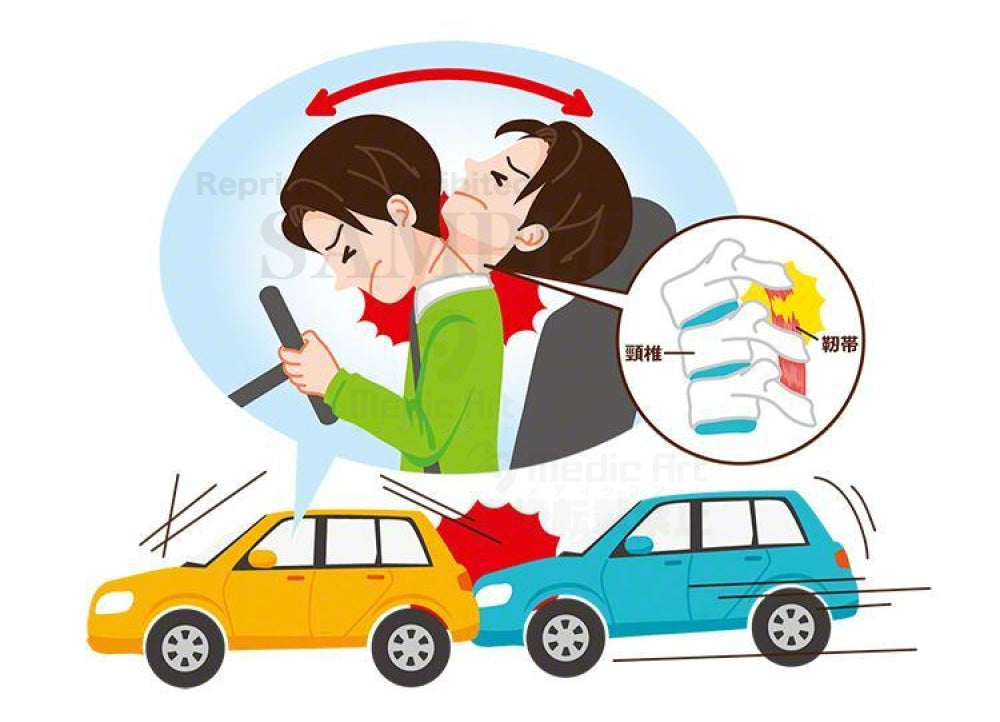 The man who suffers from a whip symptom by car crash2