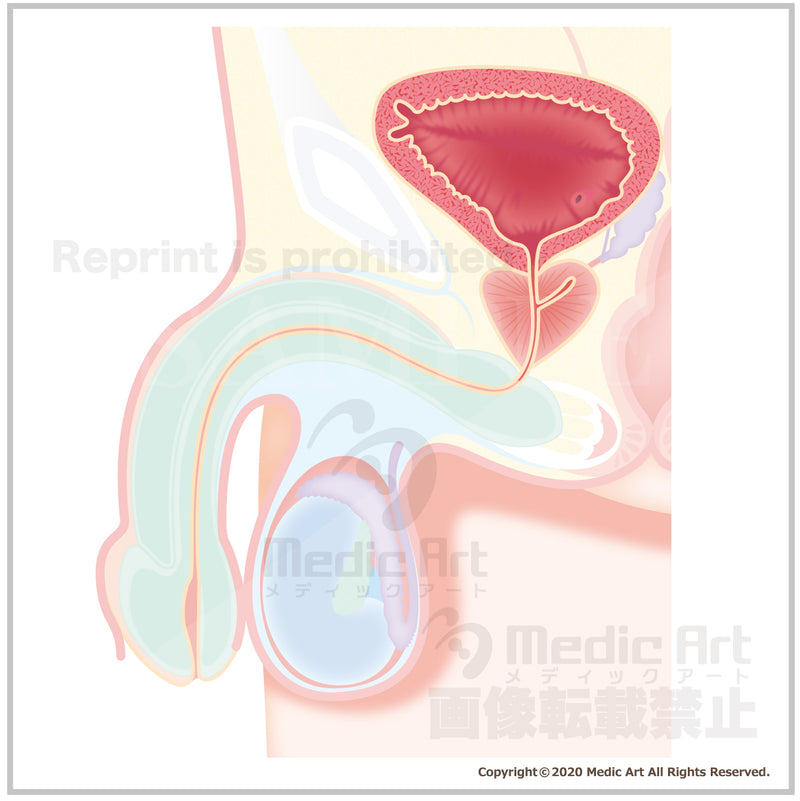 Prostate position and prostatic hypertrophy 1 (side)