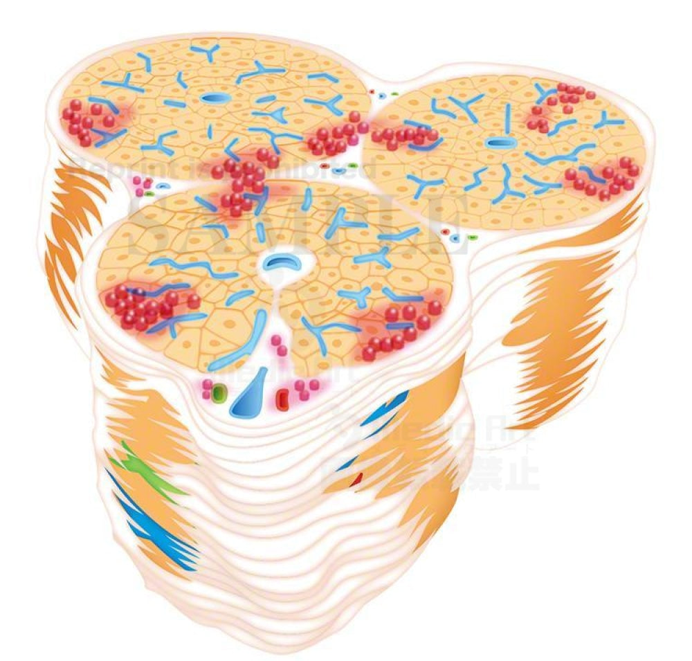 Chronic hepatitis(Enlarged focus of disease)