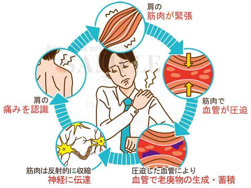 肩こりが起こるしくみ