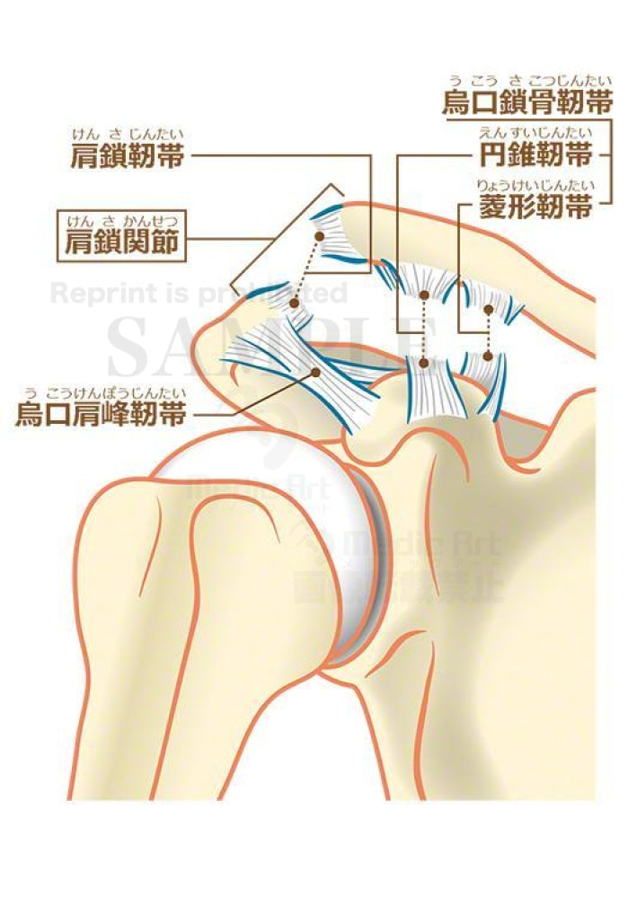 Acromioclavicular joint dislocation[With Japanese characters]