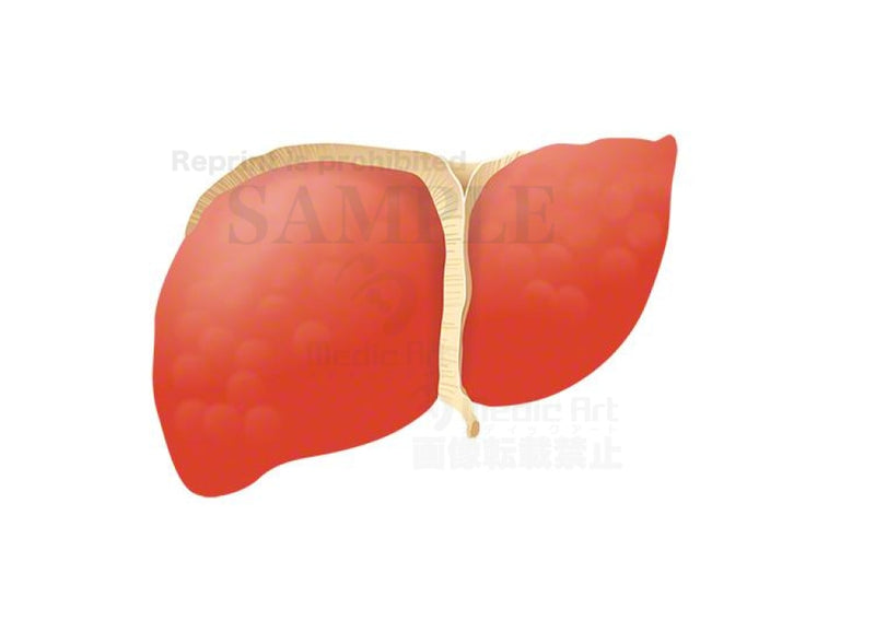 Enlarged views of liver suffering from acute?hepatitis