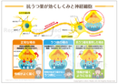 抗うつ薬(SSRI:セロトニン再取り込み阻害薬)が効くしくみと神経細胞 ［シート］
