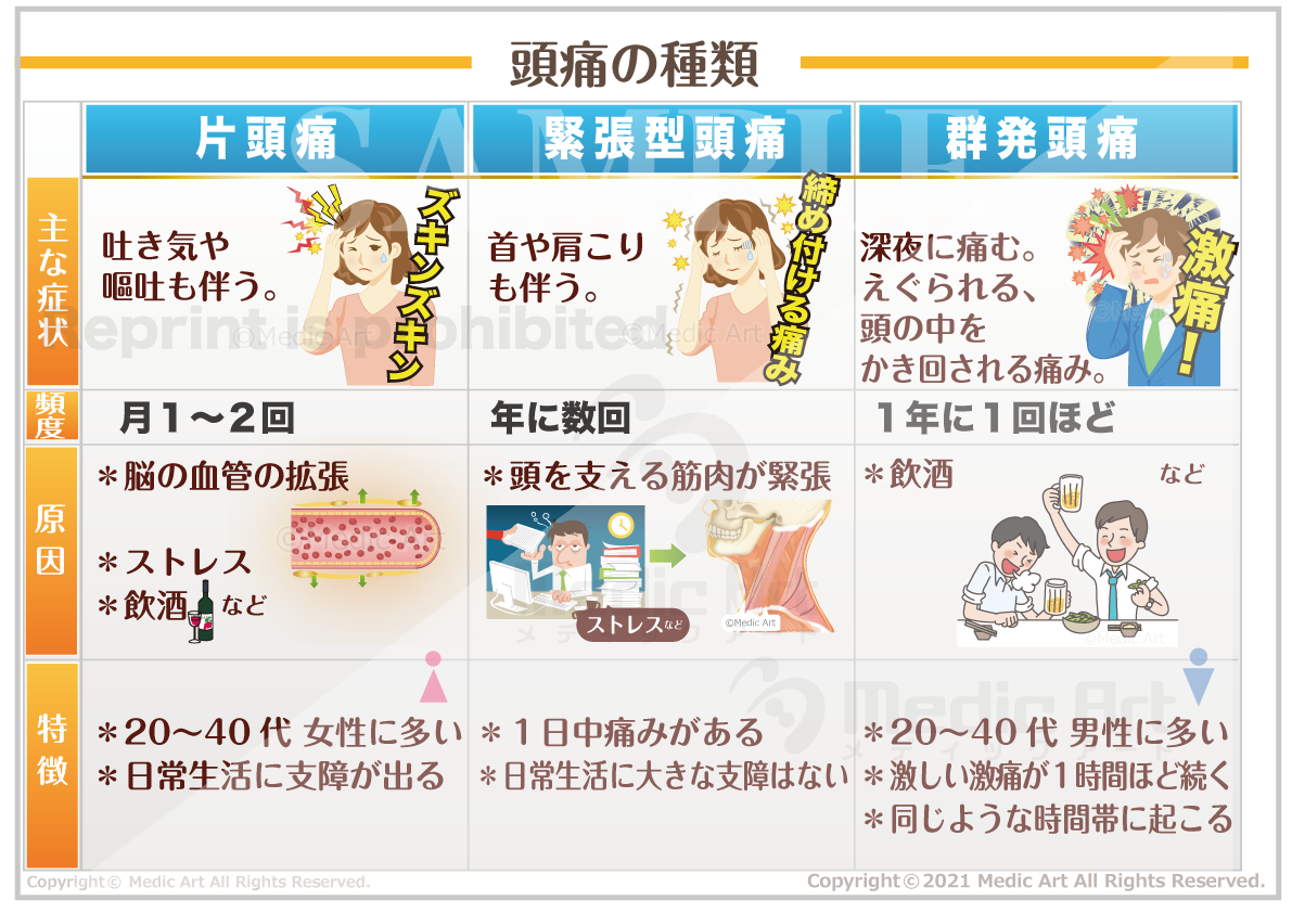 頭痛の種類 ［シート］