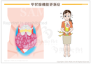 甲状腺機能更新症［シート］