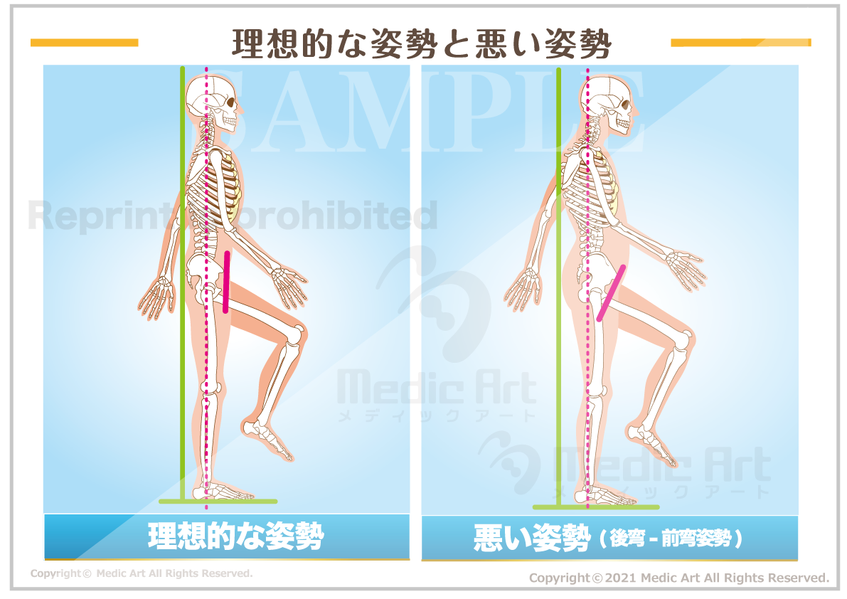 理想姿勢と良くない姿勢［シート］