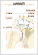 【骨・関節の病気】肩鎖関節脱臼（けんさかんせつだっきゅう） ［シート］